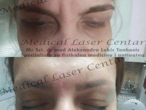 estetic-anti-aging-medical-laser-centar-6dced2-5.jpg