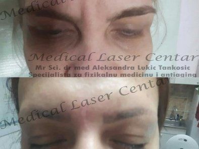Estetic Anti Aging Medical Laser Centar