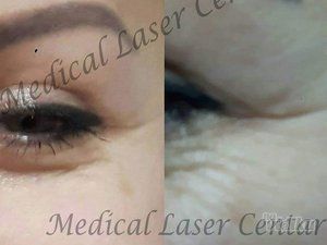 estetic-anti-aging-medical-laser-centar-6dced2-6.jpg