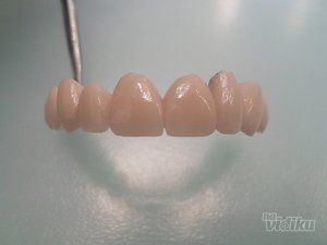 zubni-implantati-bca7de-9.jpg