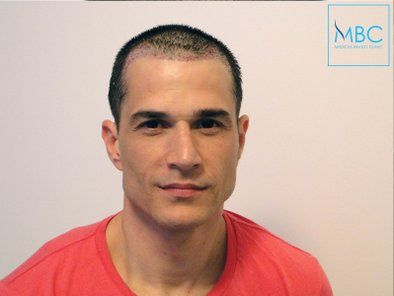 MBC Medical Beauty Centar