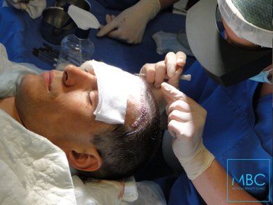 MBC Medical Beauty Centar