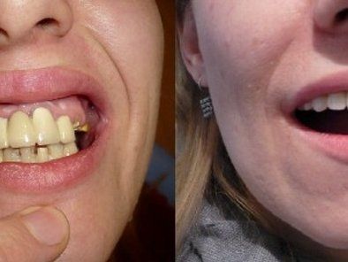 Luna dent Medaković stomatološka ordinacija