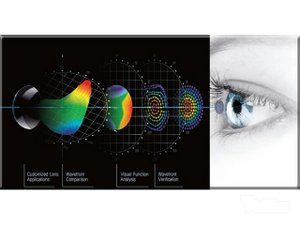 oftalmoloska-ordinacija-look-optic-58daa9-2.jpg