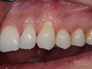 dream-dent-stomatoloska-ordinacija-6353c8-12.jpg