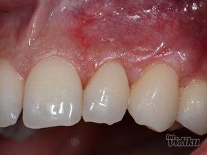 dream-dent-stomatoloska-ordinacija-6353c8-13.jpg