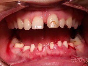 dream-dent-stomatoloska-ordinacija-6353c8-14.jpg
