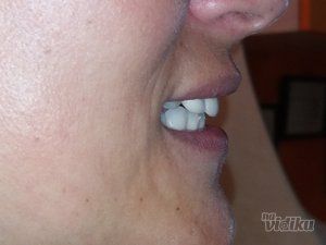 dream-dent-stomatoloska-ordinacija-6353c8-15.jpg