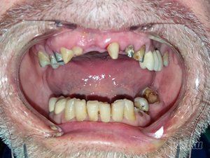 dream-dent-stomatoloska-ordinacija-6353c8-17.jpg