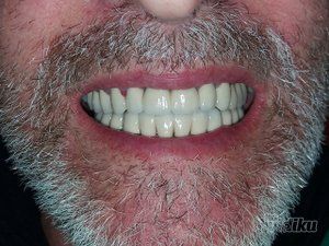 dream-dent-stomatoloska-ordinacija-6353c8-18.jpg