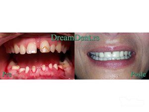 dream-dent-stomatoloska-ordinacija-6353c8-19.jpg