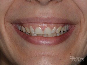 dream-dent-stomatoloska-ordinacija-6353c8-8.jpg