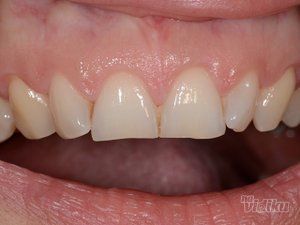 dream-dent-stomatoloska-ordinacija-6353c8-9.jpg
