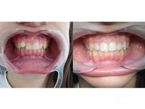 dentiva-stomatoloska-ordinacija-c9b1e6-5.jpg