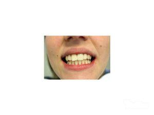 bi-dental-studio-stomatoloska-ordinacija-6039f5-1.jpg