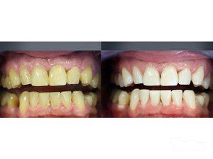 bi-dental-studio-stomatoloska-ordinacija-6039f5.jpg