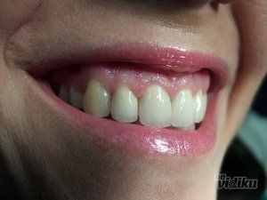 stomatoloska-ordinacija-dentart-bg-62f754-4.jpg