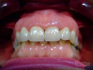 stomatoloska-ordinacija-dentart-bg-62f754-5.jpg