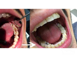 belgradent-stomatoloska-ordinacija-44e8a1.jpg