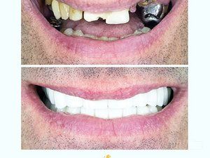 lavin-dental-clinic-stomatoloska-ordinacija-b7c158-3.jpg