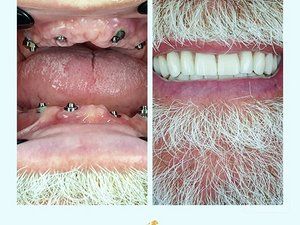 lavin-dental-clinic-stomatoloska-ordinacija-b7c158.jpg