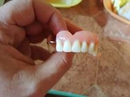 zubne-proteze-zivic-824364-1.jpg