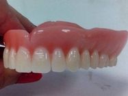 zubne-proteze-zivic-824364.jpg