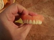 zubne-proteze-zivic-824364-2.jpg
