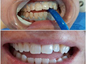 smile-in-dental-stomatoloska-ordinacija-ed5239-10.jpg