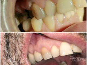 smile-in-dental-stomatoloska-ordinacija-ed5239-11.jpg