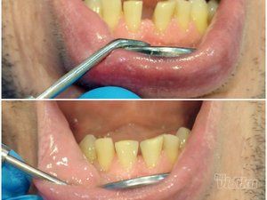 smile-in-dental-stomatoloska-ordinacija-ed5239-8.jpg