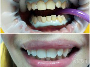 smile-in-dental-stomatoloska-ordinacija-ed5239-9.jpg