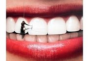 Hemijsko beljenje zuba u ordinaciji