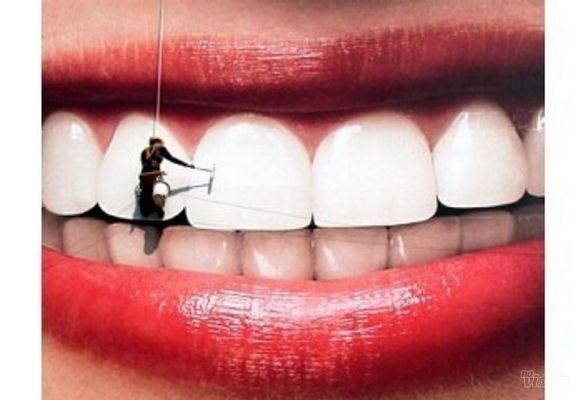 Hemijsko beljenje zuba u ordinaciji