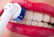 Uklanjanje zubnog kamenca uz BESPLATNO uklanjanje mekih naslaga