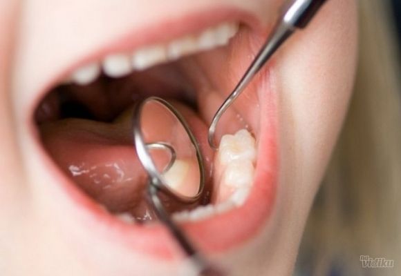 Bezbolno vađenje zuba