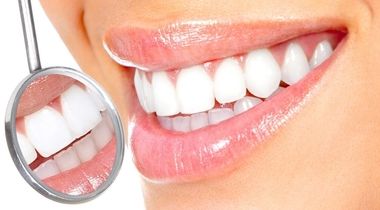 Kućno izbeljivanje zuba (obe vilice) 2 folije + 1 tuba gela