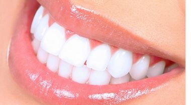 Kućno beljenje zuba Opalescence materijalom!