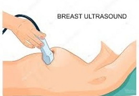 Ultrazvuk dojki