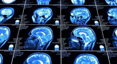 Pregled neurohirurga + skener glave bez kontrasta