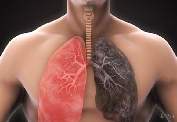 Pulmološki paket: pregled pulmologa + spirometrija + tumačenje donetog rendgena ili skenera pluća