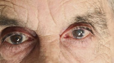 Dijagnostika glaukoma: kompletan pregled + kompjuterizovano vidno polje + OCT snimak vidnog živca
