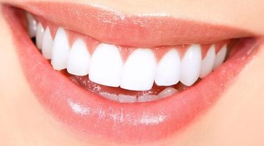 Izbeljivanje zuba + uklanjanje naslaga i poliranje + pregled