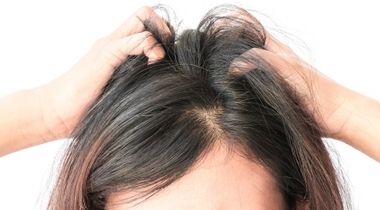 Mezoterapija kose za zaustavljanje opadanja i stimulaciju ponovnog rasta