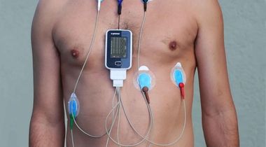 Holter paket: 24h holter EKG-a i 24h holter pritiska