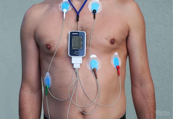Holter paket: 24h holter EKG-a i 24h holter pritiska bez očitavanja