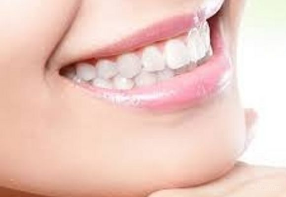 Ordinacijsko izbeljivanje zuba (cena za obe vilice) - SUPER CENA!