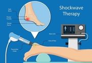 Shock Wave terapija