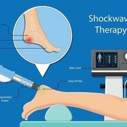 Shock Wave terapija