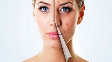 Pregled dermatologa - iskoristite popust od 50% na SVE DERMATOLOŠKE usluge!